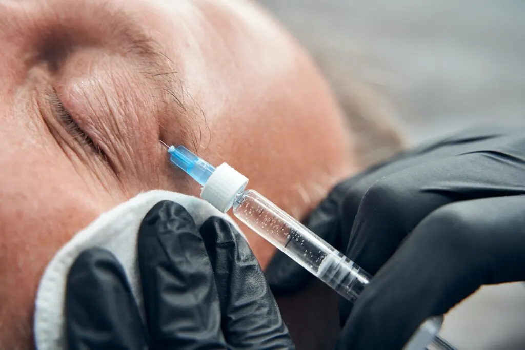 How Long Does Blepharoplasty Surgery Take? A Complete Guide