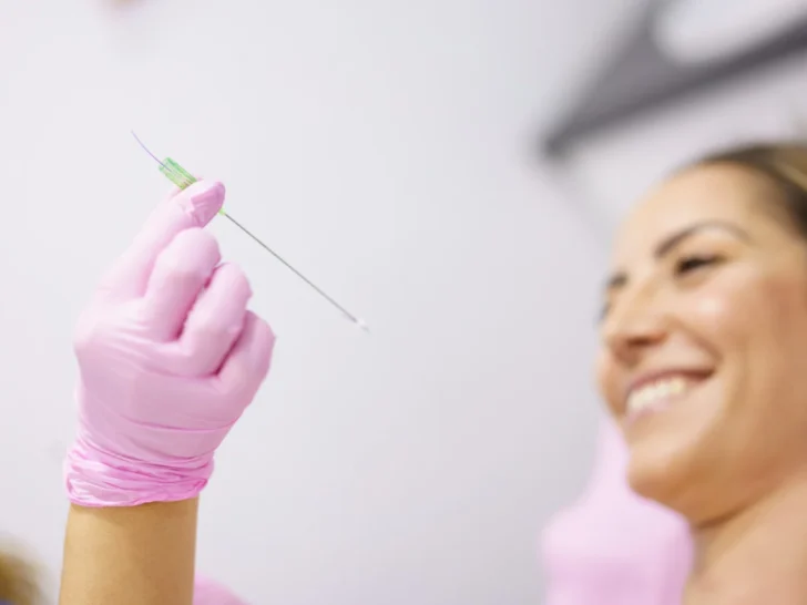 What Are Facial Threads?