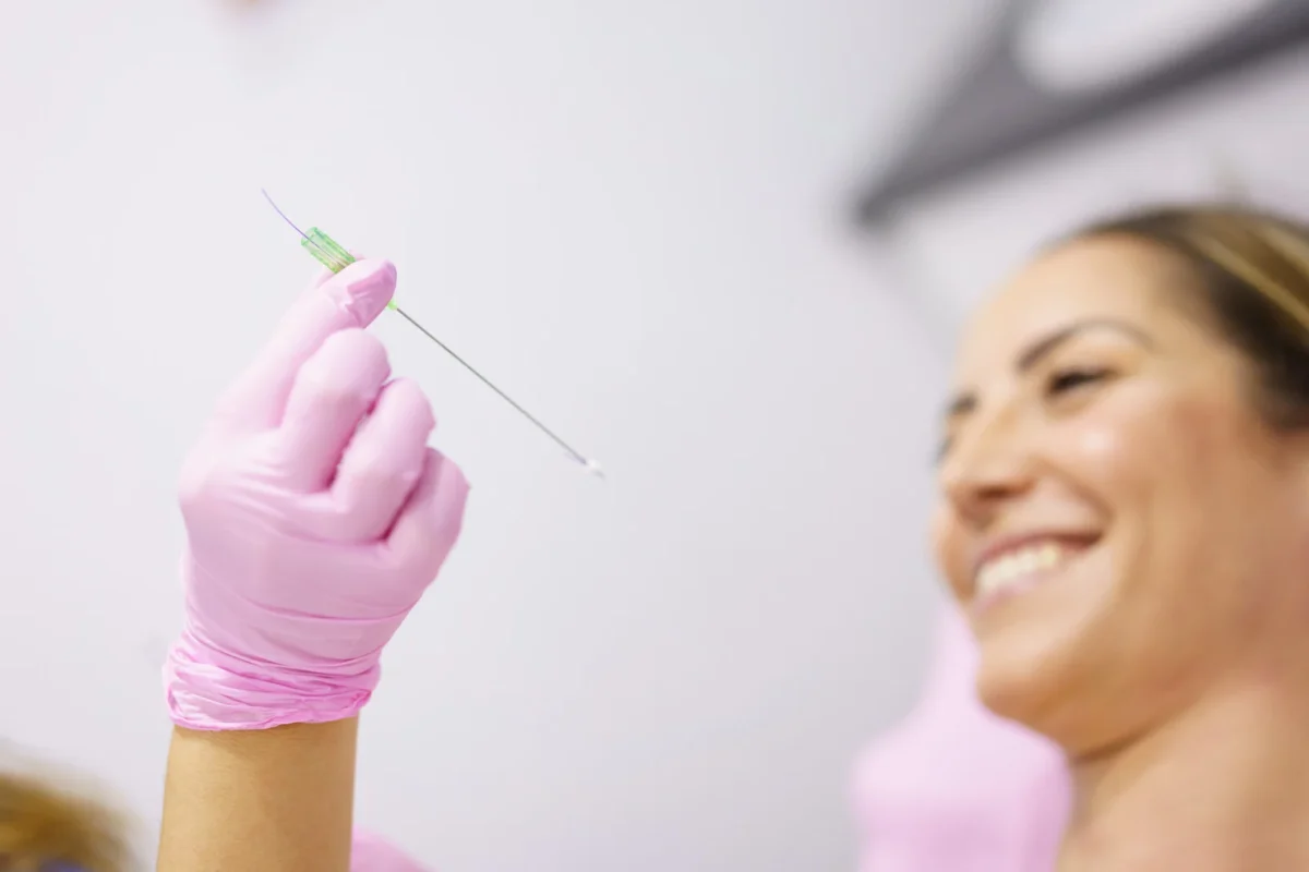 a doctor showing a patient what a facial thread is, what are facial threads
